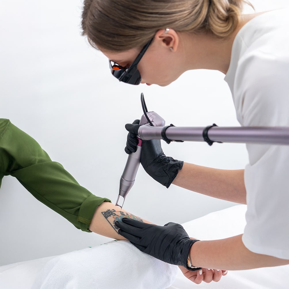Laser Tattoo Removal min