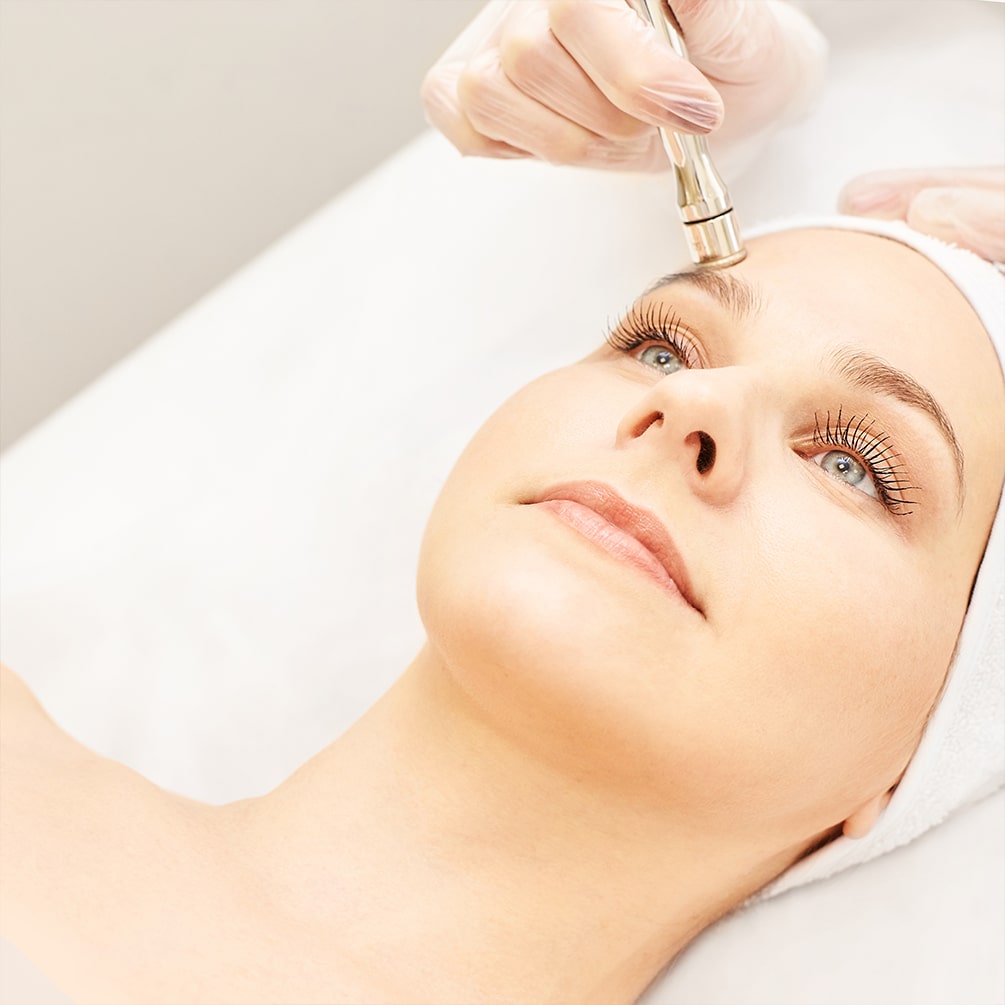 Microdermabrasion min