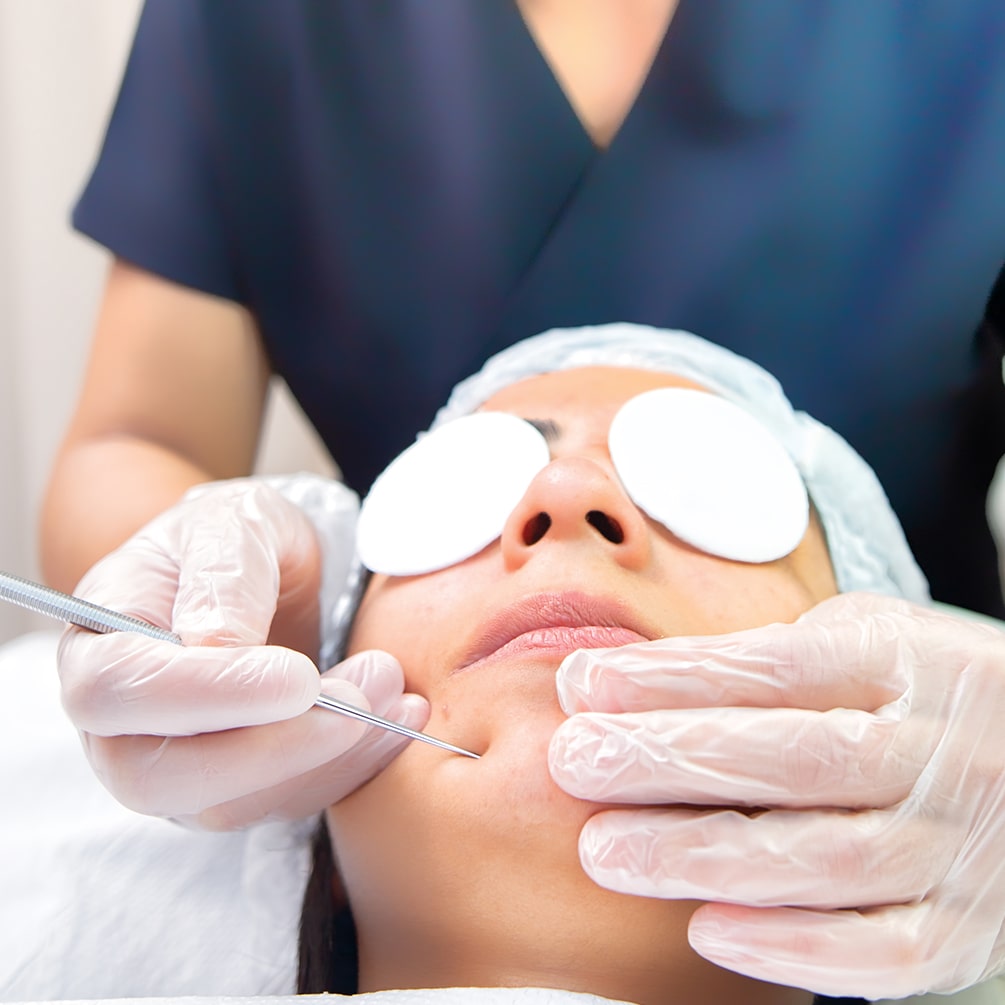 SculptraCosmeticFiller min