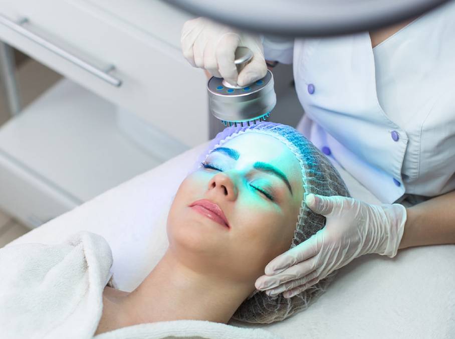 Laser Acne Scar Removal