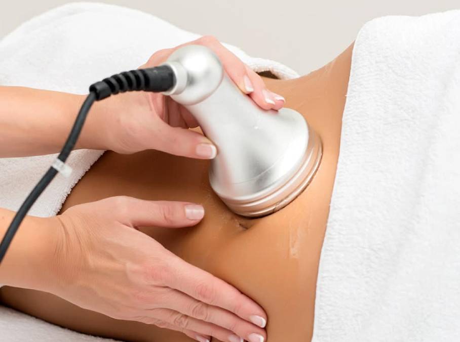 RFSkinTightening
