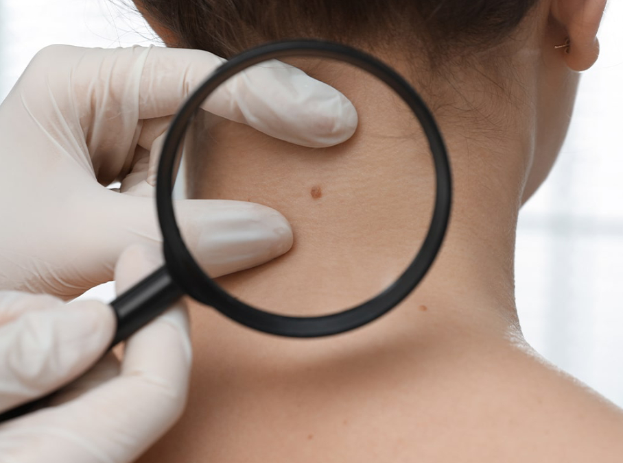 SkinTag