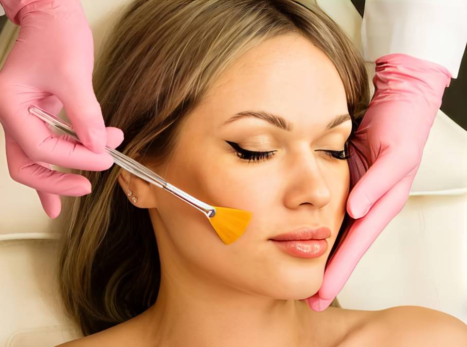 chemical peel scaled