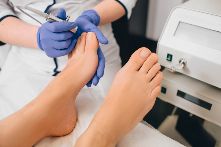 laser treatment on toenail, fungal infection on the toenails