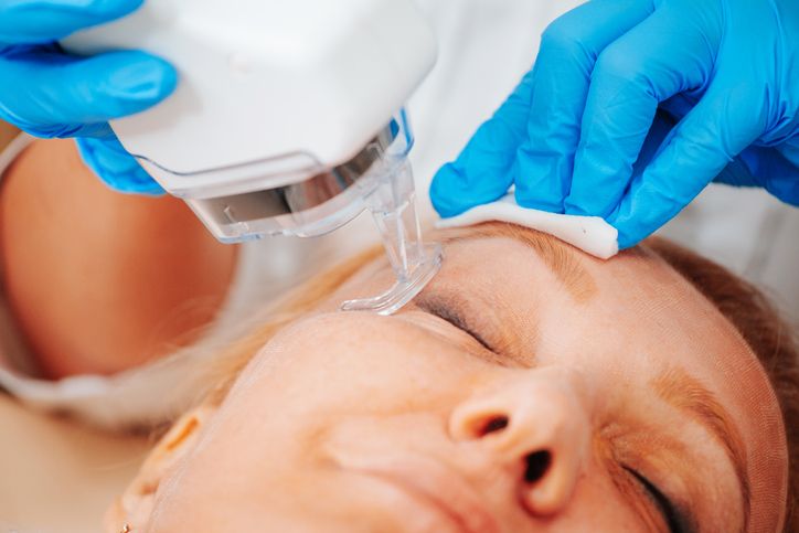 Fractional laser resurfacing is a unique technique for skin rejuvenation