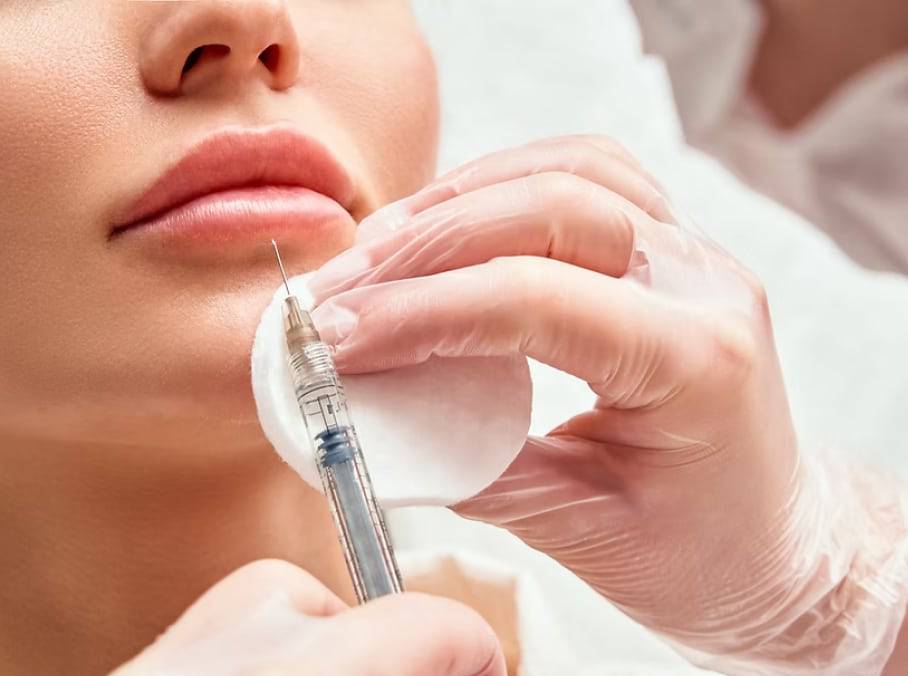 lip filler 2