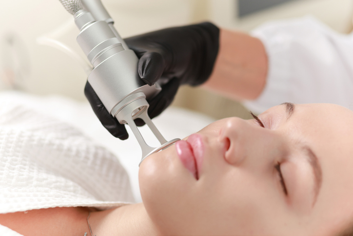 CO2 carbon dioxide laser resurfacing cosmetology procedure