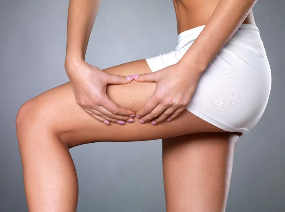 rf skin tightening
