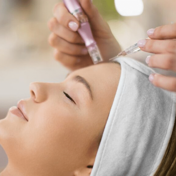 Microneedling1 768x572